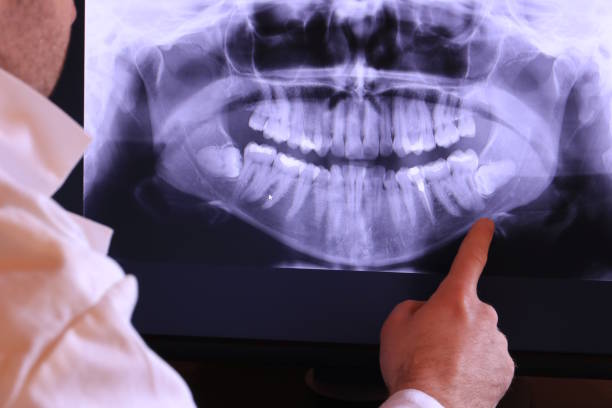 Best Chipped Tooth Repair Near Me  in Pleasant Hill, MS